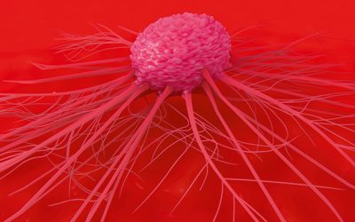 UK study finds screening with a PSA test in prostate cancer can lead to overdiagnosis