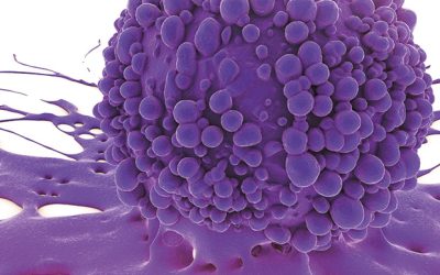 ICR discovers major biological processes in myeloma development