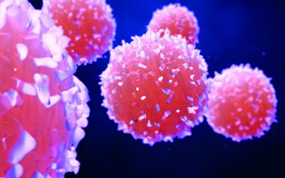 Womb condition checks could reduce cancer risk in endometrial hyperplasia